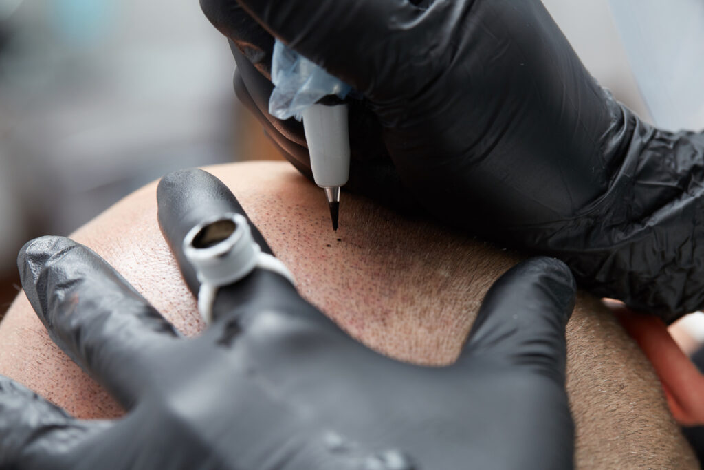 What is the difference between Scalp tattooing and Scalp Micropigmentation (SMP)?