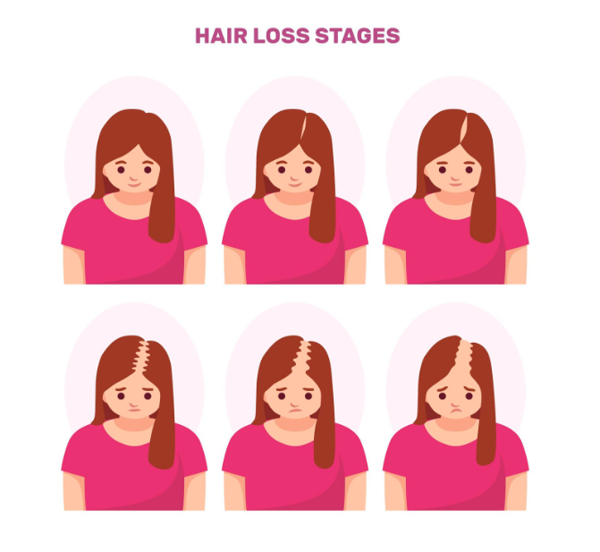 Women Hair Thinning Solution