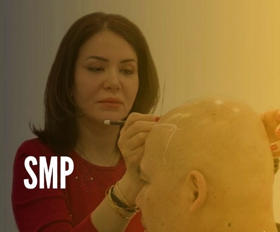 SMP Hair Line  restoration in Toronto